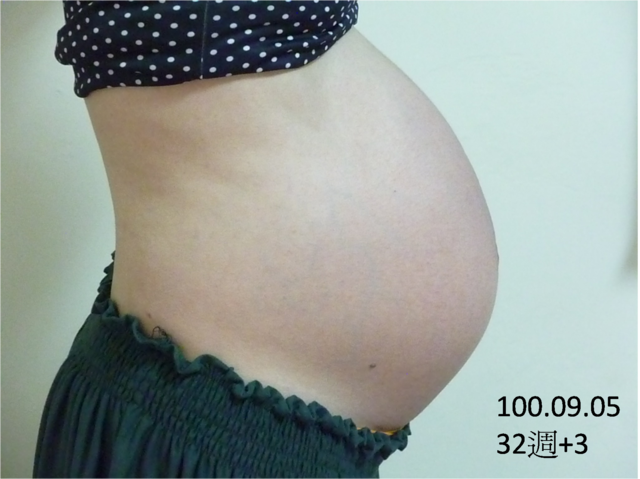 100年9月：展開2週1次密集產檢，母子體重控制成功【31~32週】 - 雨立今=霠